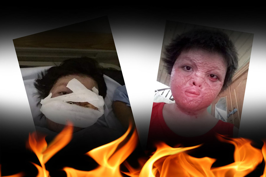 Hai cô gái xinh đẹp bị chồng thiêu sống: Đớn đau tìm lại hình hài tươi sáng - ảnh 3