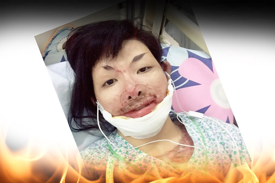 Hai cô gái xinh đẹp bị chồng thiêu sống: Đớn đau tìm lại hình hài tươi sáng - ảnh 8