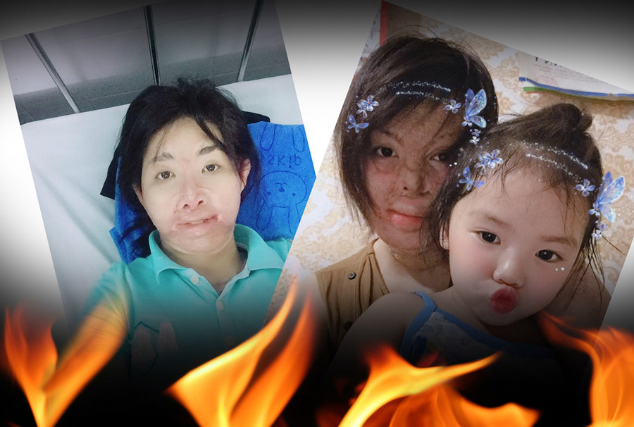 Hai cô gái xinh đẹp bị chồng thiêu sống: Đớn đau tìm lại hình hài tươi sáng - ảnh 4