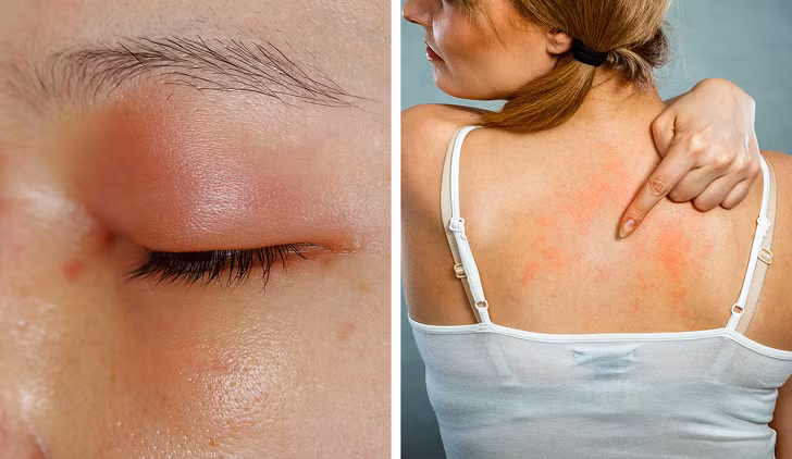 day la nhung dieu bac si khong bao gio noi ra khi ke khang sinh hinh anh 6