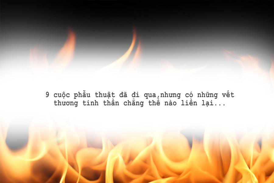 Hai cô gái xinh đẹp bị chồng thiêu sống: Đớn đau tìm lại hình hài tươi sáng - ảnh 6