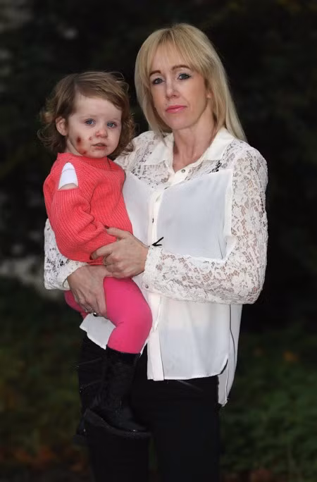 Mẹ bé Willow-Ivy Doherty vô cùng thương xót cho con gái