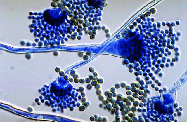 mot gia dinh bon nguoi mac benh ung thu, nguyen nhan chi vi chat ton tai xung quanh moi nguoi - 2