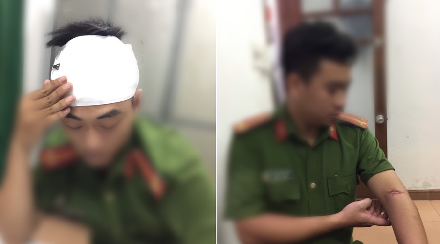 Trung úy Long bị thương ở đầu và Trung úy Sang bị thương ở tay sau khi bị đối tượng dùng dao chém. Trung úy Long bị thương ở đầu và Trung úy Sang bị thương ở tay sau khi bị đối tượng dùng dao chém.