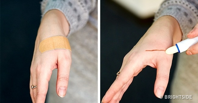 9 công dụng hay mà ít người biết của thỏi son dưỡng môi ảnh 3 Son dưỡng môi có thể làm giảm ngứa và làm dịu vết xước.