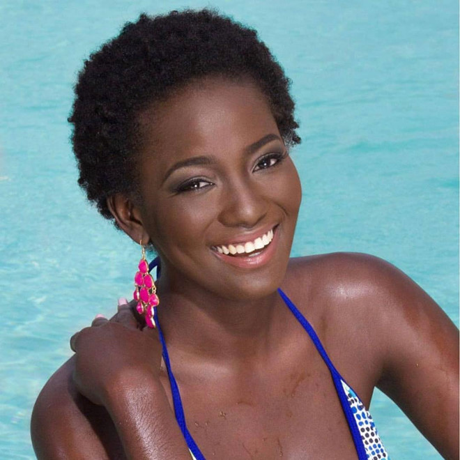 Zandrea Bailey qua đời ở tuổi 29 vì mắc bệnh lupus. Ảnh:Instagram. Nguoi dep Hoa hau Hoan vu Jamaica 2014 qua doi o tuoi 29 hinh anh 1