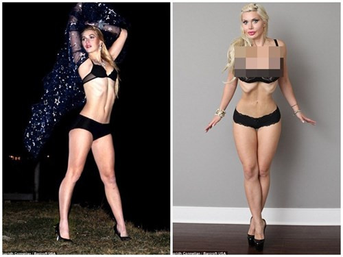 Pixee đã chi đến 120.000 USD để phẫu thuật thẩm mỹ nhiều bộ phận trên cơ thể