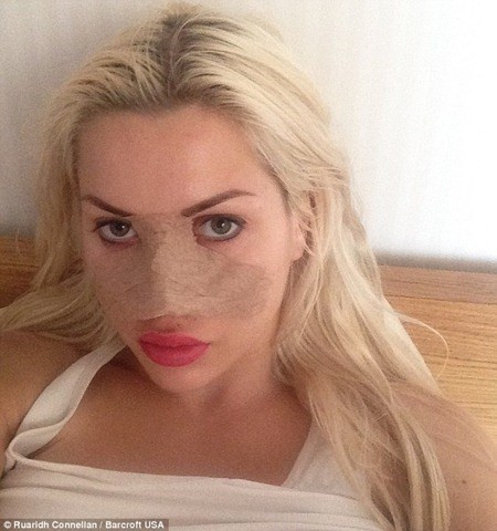 Cô nàng trải qua 15 cuộc phẫu thuật để có diện mạo như bây giờ