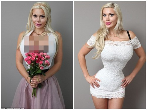 Cắt 6 xương sườn để có vòng eo con kiến ảnh 8