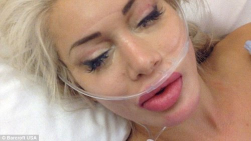 Cấy mũi và bơm môi