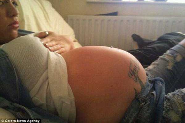 Kinh hãi những căn bệnh ‘quái dị’ nhất thế giới ảnh 5 Kinh hãi những căn bệnh ‘quái dị’ nhất thế giới