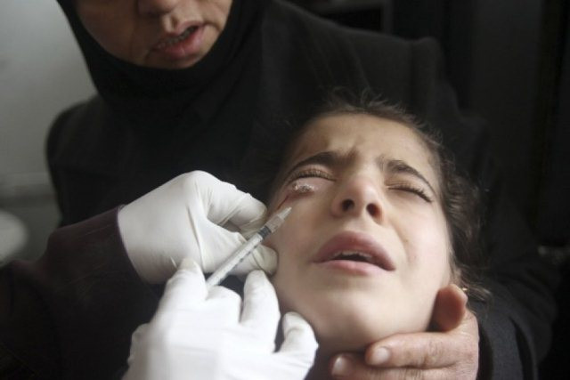 Một em bé Syria bị mắc bệnh Leishmaniasis trong máu vào năm 2013. Nhà khoa học-bác sĩ Jacinto Convit đã cống hiến đời mình cho các bệnh truyền nhiễm, cụ thể là bệnh phong. Ảnh: Muzaffar Salman/Reuters/Corbis Một em bé Syria bị mắc bệnh Leishmaniasis trong máu vào năm 2013. Nhà khoa học-bác sĩ Jacinto Convit đã cống hiến đời mình cho các bệnh truyền nhiễm, cụ thể là bệnh phong. Ảnh: Muzaffar Salman/Reuters/Corbis