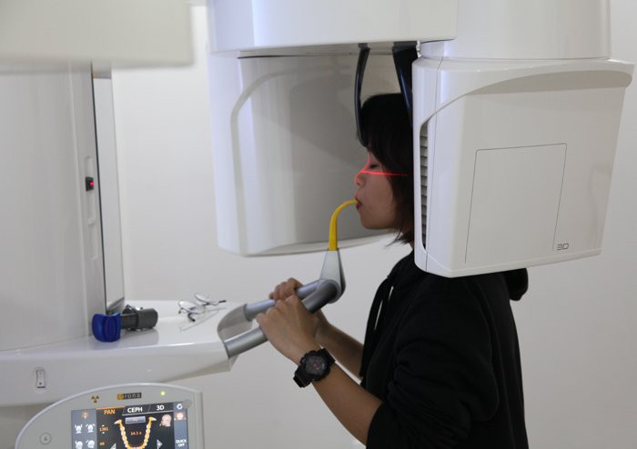 Bác sĩ nha khoa tiết lộ những tai nạn không ai ngờ khi niềng răng