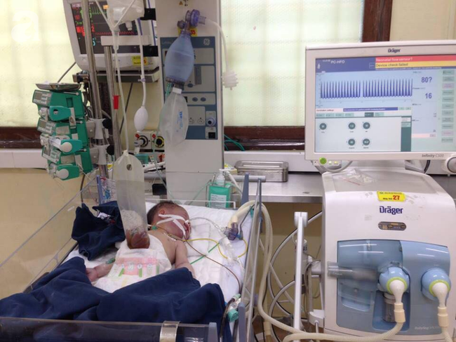 Chồng chết lặng sau khi đỡ đẻ cho vợ thấy đứa con gái có bộ nội tạng lòi hoàn toàn ra ngoài - Ảnh 3. Chồng chết lặng sau khi đỡ đẻ cho vợ thấy đứa con gái có bộ nội tạng lòi hoàn toàn ra ngoài - Ảnh 3.