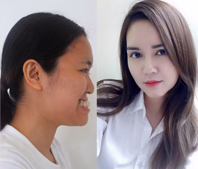 8 ca tham my cua chi em viet gay bao du luan vi bien "gai xau thanh tien" hinh anh 11