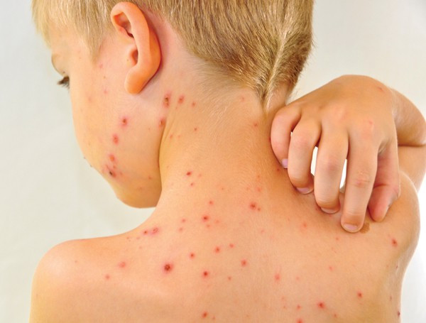 Tai hại tự điều trị cho trẻ bằng phương pháp truyền miệng - Ảnh 1. Tai hại tự điều trị cho trẻ bằng phương pháp truyền miệng - Ảnh 1.
