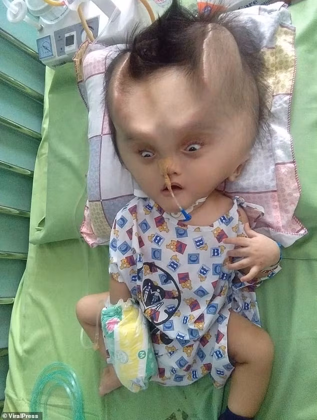 be trai moc “sung cua quy” ky la hinh anh 2