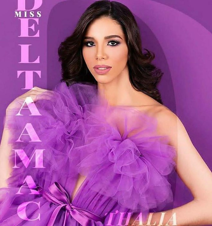 Nhan sắc gây tranh cãi của người đẹp vừa đăng quang Hoa hậu Venezuela ảnh 4 Nhan sắc gây tranh cãi của người đẹp vừa đăng quang Hoa hậu Venezuela ảnh 4