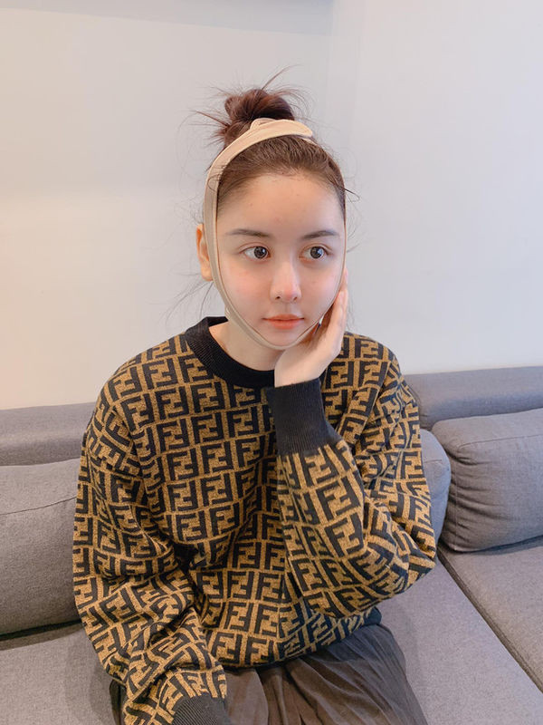 Vẫn là gương mặt ấy nhưng Hà Lade lại lộ xương hàm lệch, nghi là do di chứng thẩm mĩ? ảnh 1