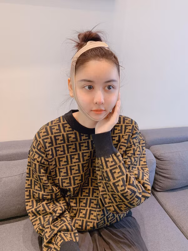 Vẫn là gương mặt ấy nhưng Hà Lade lại lộ xương hàm lệch, nghi là do di chứng thẩm mĩ? ảnh 1