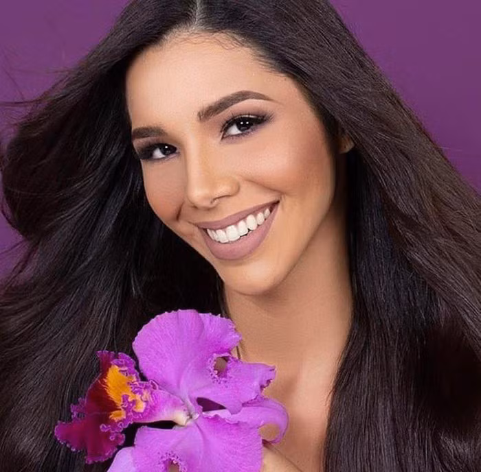 Nhan sắc gây tranh cãi của người đẹp vừa đăng quang Hoa hậu Venezuela ảnh 5