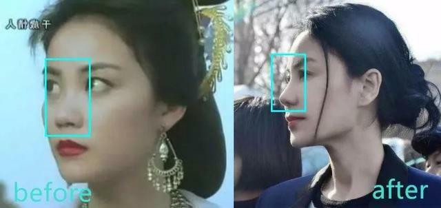 Chiếc mũi với sống thấp, cánh mũi to giờ được "thu gọn". Vương Phi lộ nhiều bằng chứng dao kéo - 2