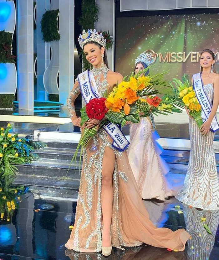 Nhan sắc gây tranh cãi của người đẹp vừa đăng quang Hoa hậu Venezuela ảnh 2 Nhan sắc gây tranh cãi của người đẹp vừa đăng quang Hoa hậu Venezuela ảnh 2