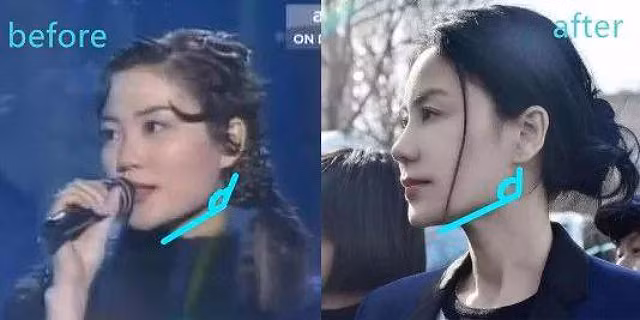 Vương Phi lộ nhiều bằng chứng dao kéo