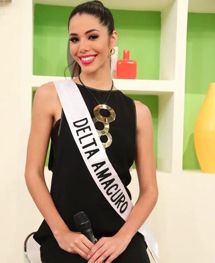 Nhan sắc gây tranh cãi của người đẹp vừa đăng quang Hoa hậu Venezuela ảnh 8 Nhan sắc gây tranh cãi của người đẹp vừa đăng quang Hoa hậu Venezuela ảnh 8