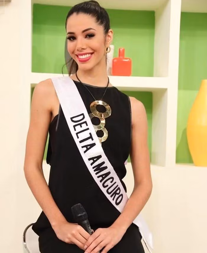 Nhan sắc gây tranh cãi của người đẹp vừa đăng quang Hoa hậu Venezuela ảnh 8