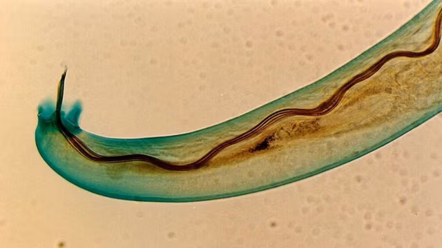 Nuốt sống con sên rồi chết thảm sau 8 năm - con sên ấy đã làm gì mà gây ra thảm họa khủng khiếp này? ảnh 1