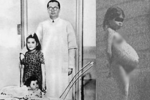 Lina Medina có thai khi mới 5 tuổi. Lina Medina được chẩn đoán có thai khi mới 5 tuổi. Ảnh: Allthatsinteresting
