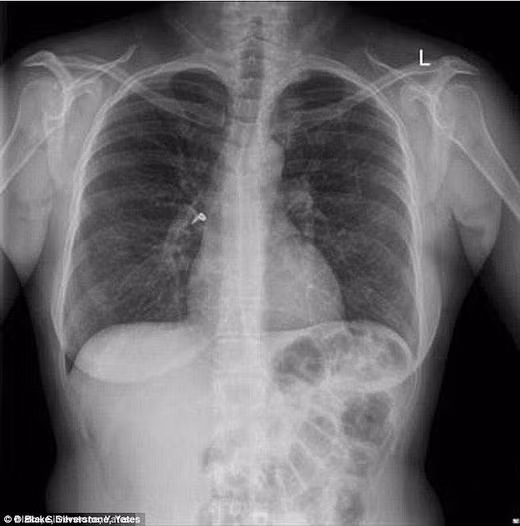 Những ca bệnh “sốc” bạn không tin nhưng có thật ảnh 1