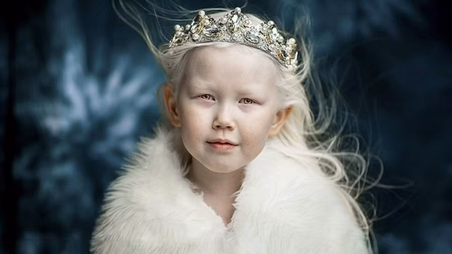 Nariyana:Với mái tóc bạch kim cùng làn da trắng như sứ, Nariyana được mệnh danh "Bạch Tuyết của Siberia". Cô bé 8 tuổi là con thứ hai trong gia đình bình thường với mái tóc đen đặc trưng ở Siberia. Nhưng căn bệnh bạch tạng khiến Nariyana khác biệt với các anh chị em trong nhà. Ảnh:Boredpanda. Ve dep cua nhung nguoi mau bach tang noi tieng hinh anh 7