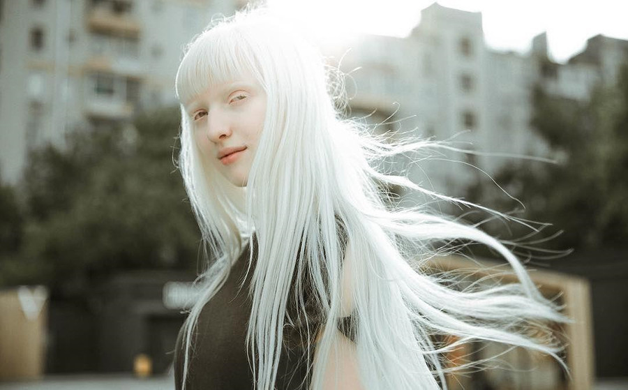 Nastya Kumarova Zhidkova:Sinh ra tại Moscow, Nga, Nastya được mệnh danh là người mẫu bạch tạng đẹp nhất thế giới. Sở hữu làn da trắng muốt, mái tóc bạch kim và đôi mắt to cuốn hút, cô như một công chúa tuyết bước ra từ câu chuyện cổ tích. Tuy vậy, với vẻ ngoài kỳ lạ, từ nhỏ, Nastya luôn bị những người xung quanh kỳ thị. Không bận lòng vì những lời bàn tán đó, cô luôn tự tin khoe vẻ đẹp của mình trong từng bộ ảnh. Ảnh:Listal. Ve dep cua nhung nguoi mau bach tang noi tieng hinh anh 5