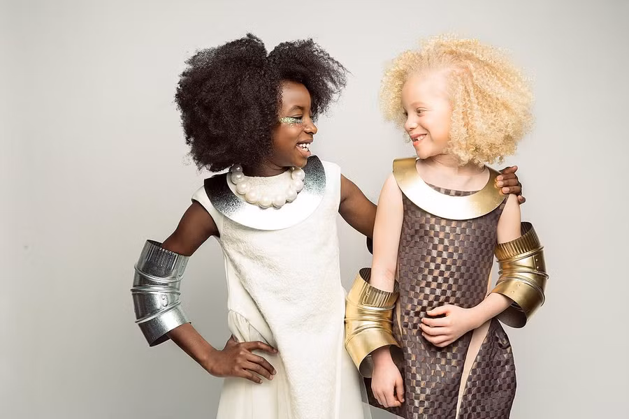 Nhìn mái tóc xoăn bạch kim, đôi mắt xanh lá pha xanh biển của Ava Clarke, không ai có thể nghĩ rằng cô bé lại mắc căn bệnh kỳ lạ này. Dù còn nhỏ tuổi, Ava đã xuất hiện và luôn nổi bật trên các tạp chí thời trang nhưVogue, Denim, vàVIP. Ảnh:Noticiasya. Ve dep cua nhung nguoi mau bach tang noi tieng hinh anh 10