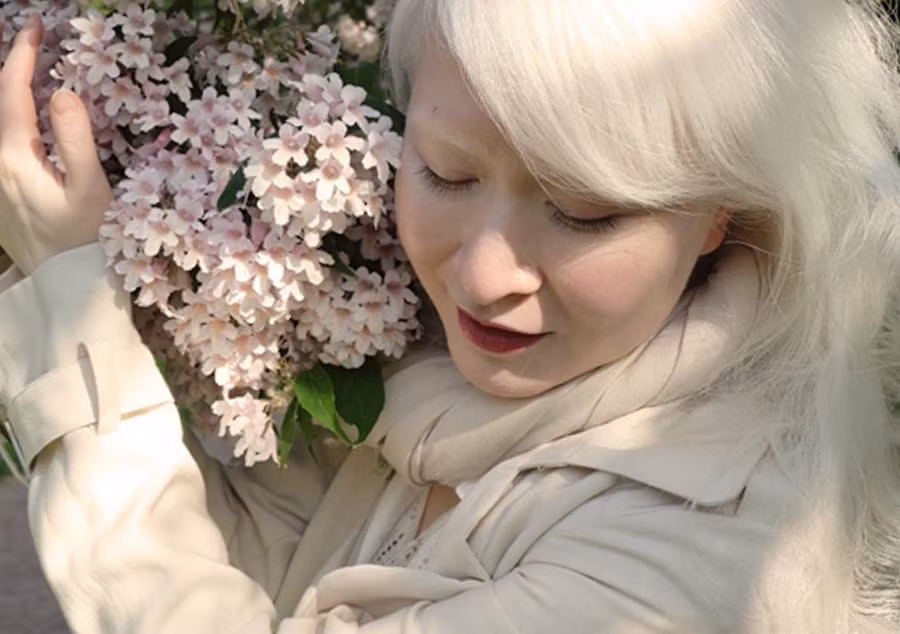 Chỉ cao 1,68 m nhưng người mẫu gốc Hong Kong vẫn được chọn để trình diễn trên các sàn catwalk lớn, cũng như chụp hình cho các tạp chí nổi tiếng vì vẻ đẹp khác biệt. Mặc dù ở nhiều nơi, người bạch tạng bị phân biệt đối xử, "người đàn bà tóc trắng" vẫn vượt lên số phận để nổi tiếng khắp thế giới. Ảnh:Famousfix. Ve dep cua nhung nguoi mau bach tang noi tieng hinh anh 2