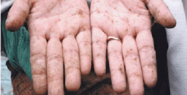 Từ video ghi lại chùm nho phun sơn hãi hùng, chuyên gia cảnh báo đồ ăn phun sơn đáng sợ thế này - Ảnh 6.