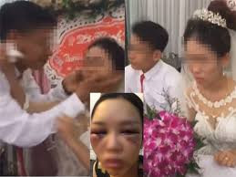 Hàng xóm sát vách hé lộ sự thật về cô dâu trẻ hất tay chồng không cho hôn trong đám cưới