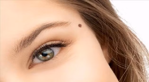 5 nốt ruồi quyết định đường tình duyên của phụ nữ: Số 1 nhớ để lại còn số 3 nên xóa