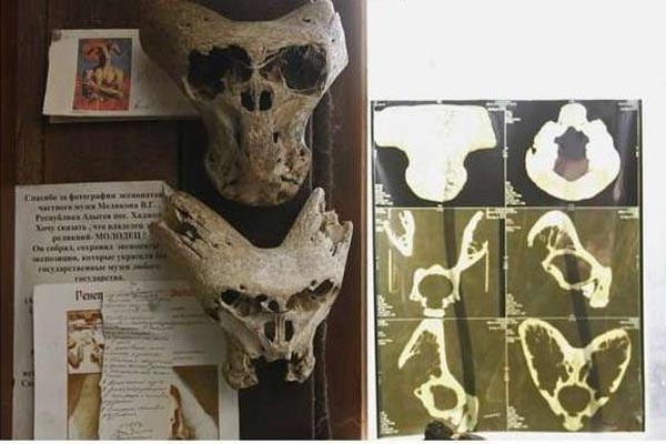 Phát hiện hai chiếc đầu lâu nghi là của người ngoài hành tinh ảnh 6