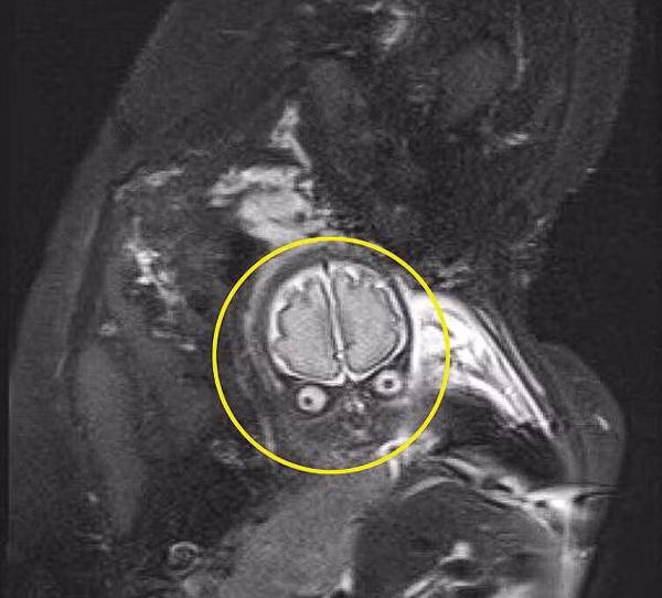 hao hung di sieu am, vua nhin man hinh me so hai: "day khong phai con toi" - 5
