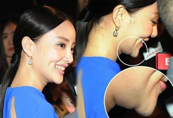 Loạt hình góc nghiêng gây bão của dàn sao châu Á: Người đẹp như tiên nữ, kẻ lộ dấu vết dao kéo - Ảnh 18. Loạt hình góc nghiêng gây bão của dàn sao châu Á: Người đẹp như tiên nữ, kẻ lộ dấu vết dao kéo - Ảnh 18.