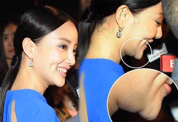 Loạt hình góc nghiêng gây bão của dàn sao châu Á: Người đẹp như tiên nữ, kẻ lộ dấu vết dao kéo - Ảnh 18.