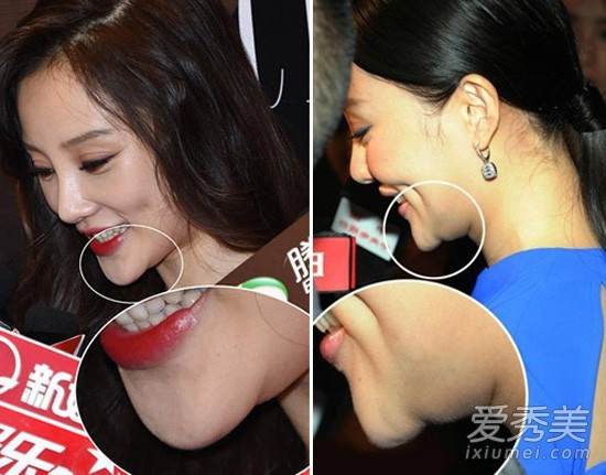 Loạt hình góc nghiêng gây bão của dàn sao châu Á: Người đẹp như tiên nữ, kẻ lộ dấu vết dao kéo - Ảnh 19. Loạt hình góc nghiêng gây bão của dàn sao châu Á: Người đẹp như tiên nữ, kẻ lộ dấu vết dao kéo - Ảnh 19.