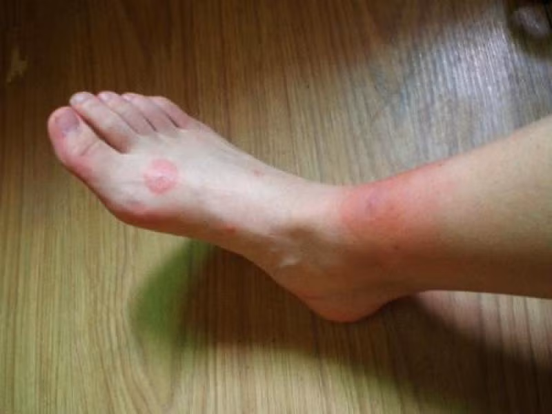 bi-con-trung-dot-can-lam-gi-1