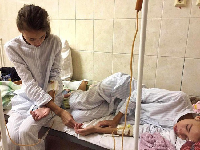 Nghe lời công ty người mẫu, 2 chị em sinh đôi xinh đẹp chỉ còn da bọc xương, nằm chờ chết