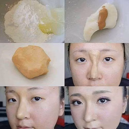 Cách nâng mũi không qua phẫu thuật.