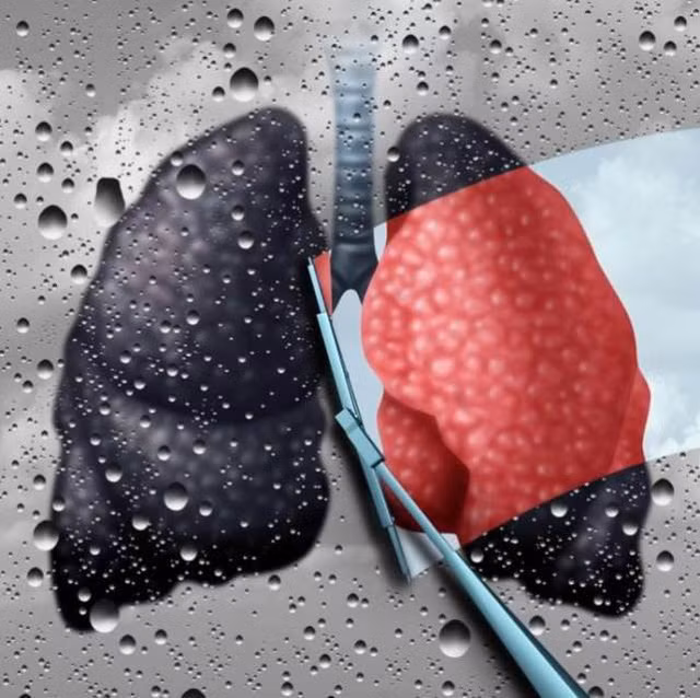 Thường xuyên ăn 5 thực phẩm này để "sạch" phổi ảnh 1