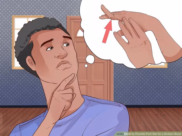 Kỹ năng sơ cứu: Cách sơ cứu khi bị gãy xương nhanh và an toàn nhất 0